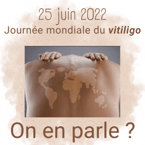 Lire la suite à propos de l’article Le vitiligo, on en parle ?